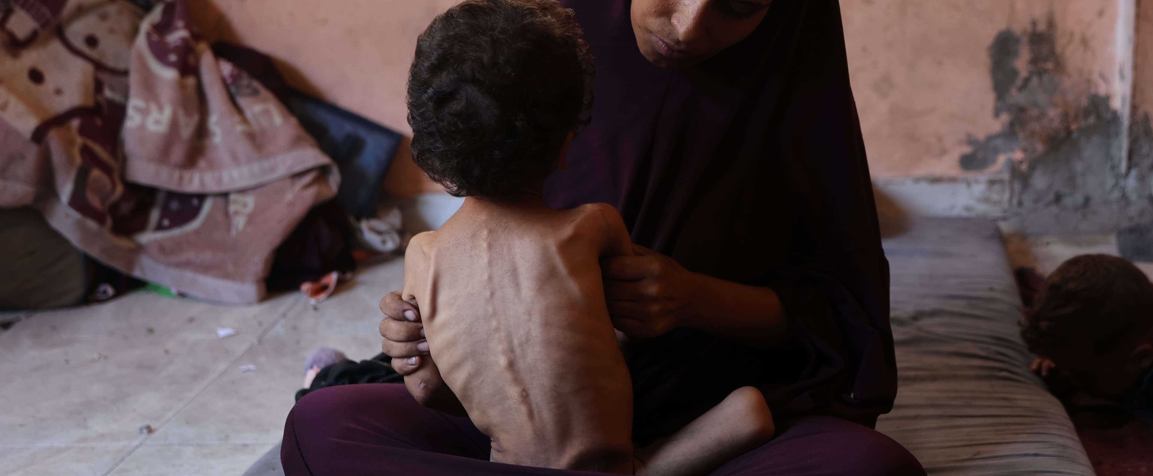 Akut undernärt barn i mammas famn - Gaza juli 2025 - cropped for desktop